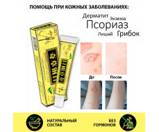 Qicaogangmu (Цикаогангму). Мазь от псориаза | 15 г